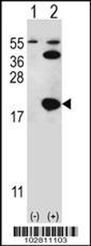 UBC9 (UBE2I) Antibody (N-term)