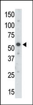 UBE1C Antibody (C-term)