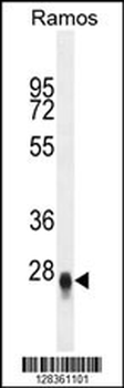 CRIP3 Antibody (Center)