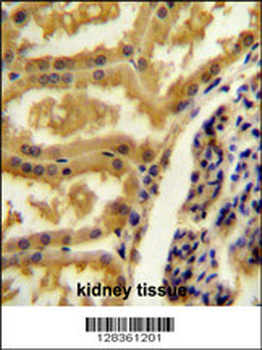 CRIP3 Antibody (Center)