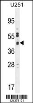CB018 Antibody (C-term)