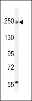 COL5A1 Antibody (N-term)