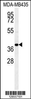 CCR8 Antibody (C-term)
