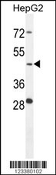 CTSA Antibody (N-term)