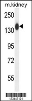 COL19A1 Antibody (N-term)