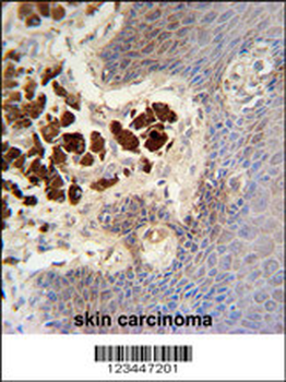 COL19A1 Antibody (N-term)