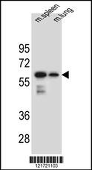 CHST3 Antibody (N-term)