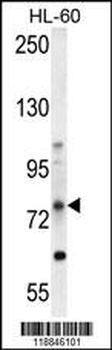 ABCD1 Antibody (Center)
