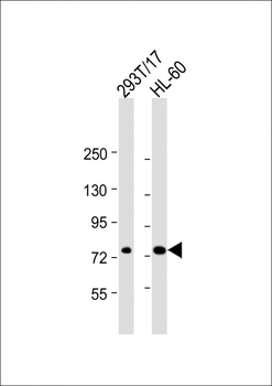 ABCD1 Antibody (Center)