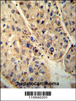 ABCD1 Antibody (Center)