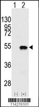 SMYD2 Antibody (N-term)