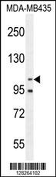 Nephrin (Y1210) antibody