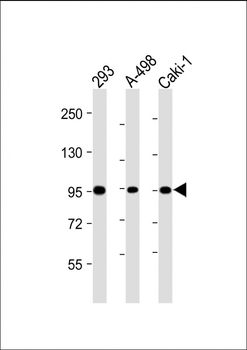 Nephrin (Y1210) antibody
