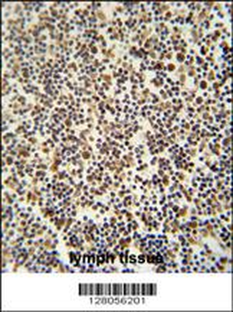 DENND1B Antibody (N-term)