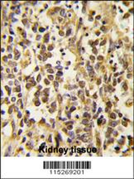 Dnmt3a Antibody (Center D472)