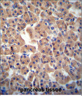 ATPBD3 Antibody (Center)