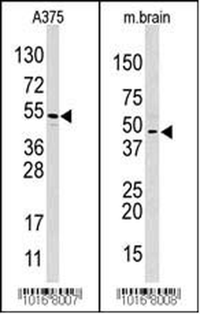 HIF1AN Antibody (C-term)