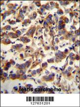 TFAM Antibody (C-term)