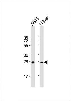 NNMT Antibody (Center)