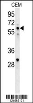 IKZF1 Antibody (C-term)
