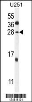 GGTLC2 Antibody (Center)