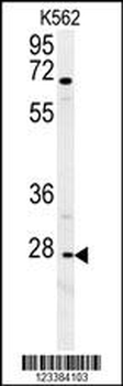 CXCR3 Antibody (Center)