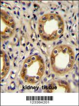 CXCR3 Antibody (Center)