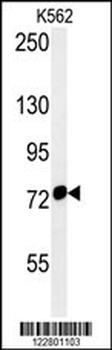 HSPA9 Antibody (Center)
