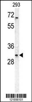 TNFRSF6B Antibody (N-term)