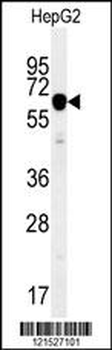 IGF2BP2 Antibody (C-term)