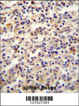 IGF2BP2 Antibody (C-term)