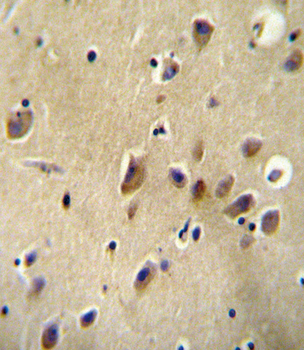 AGTR1 Antibody (Center)