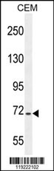 STIM1 Antibody (C-term)
