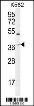 APOL6 Antibody (Center)