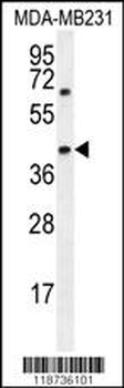 AMACR Antibody (C-term)