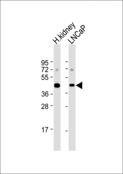 AMACR Antibody (C-term)