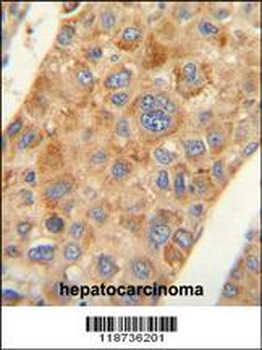 AMACR Antibody (C-term)