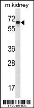 ANGPT2 Antibody (C-term)