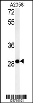 ARL14EP Antibody (C-term)