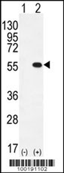 PRMT2 Antibody (C-term)
