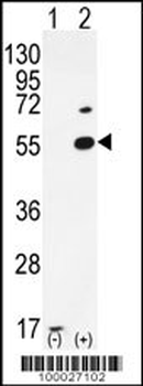 PRMT2 Antibody (N-term)