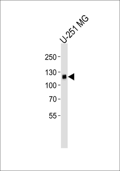 EPHA5 Antibody