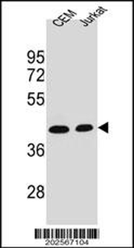 ADA Antibody (C-term)