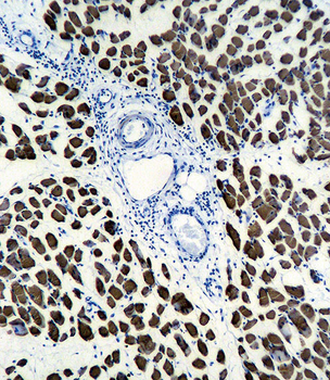 ACTA1 Antibody