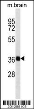 SYP Antibody (C-term)