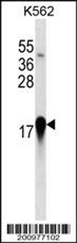 EIF4EBP1 Antibody