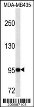 GSN Antibody (N-term)