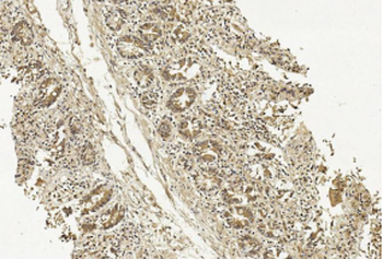 METAP1 Antibody