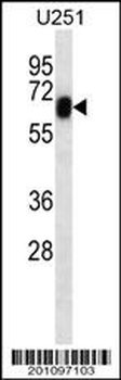 RYK Antibody