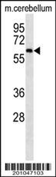 CAMKK2 Antibody